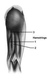   -This figure shows a posterior view of the right thigh.What muscle does number 1 indicate? A) Semitendinosus B) Semimembranosus C) Biceps femoris D) Adductor magnus E) Gluteus maximus