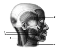   -This figure shows a lateral view of the muscles of facial expression.What muscle does number 5 indicate? A) Temporalis B) Masseter C) Buccinator D) Sternocleidomastoid E) Platysma