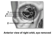   -This figure shows an anterior view of the right orbit.What muscle does number 2 indicate? A) Superior oblique B) Inferior oblique C) Lateral rectus D) Medial rectus E) Superior rectus