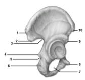  -This figure shows the os coxae.Which of these statements about the figure is correct? A) The figure shows a right bone,and number 1 indicates the anterior superior iliac spine. B) The figure shows a left bone,and number 6 indicates the ischial tuberosity. C) The figure shows a left bone and number 7 indicates the obturator foramen. D) The figure shows a right bone,and number 3 indicates the greater sciatic notch. E) The figure shows a right bone,and number 8 indicates the ischial spine.