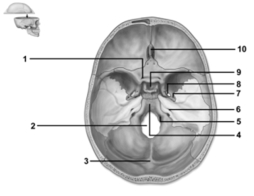   -This figure shows a superior view of the cranial cavity.Which number indicates the crista galli? A) 1 B) 3 C) 9 D) 10 E) The crista galli is not labeled on this figure.