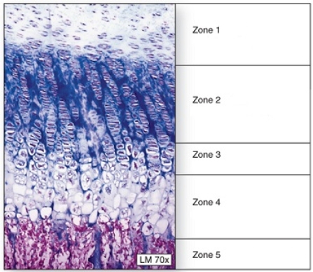   -This figure illustrates epiphyseal plate morphology.Which is the zone of proliferating cartilage? A) 1 B) 2 C) 3 D) 4 E) 5