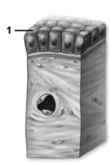   -What structure does number 1 indicate? A) Lateral surface B) Connective tissue C)  Basement membrane D) Apical surface E) Basal surface