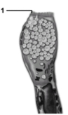  -What structures are indicated by number 1? A) Microvilli B) Secretory vesicles C) Nuclei D) Ribosomes E) Desmosomes