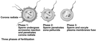 This figure shows the three phases of fertilization.Which statement is not correct concerning fertilization?   A) Digestive enzymes released from the acrosome eat away the intercellular connections in the corona radiata. B) Once a sperm has penetrated the oocyte,the zona pellucida hardens to prevent additional sperm from penetrating. C) Only the sperm nucleus enters the oocyte cytoplasm. D) Fusion of pronuclei produces a diploid nucleus. E) All of the choices are correct.