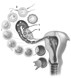   -This figure shows the transit of the pre-embryo through the uterine tube.What event does number 2 indicate? A) Fertilization B) Implantation C) Cleavage D) Gastrulation E) Ovulation
