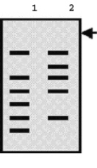 Lane 1 in the following Southern blot contains a sample from a normal control, and lane 2 contains a sample from a patient.The arrow indicates the location of the wells in the agarose gel used in this analysis.The probe used was a complementary DNA (cDNA) .Which type of mutation is most likely, on the basis of these data?   A) Point mutation that changes a codon encoding glutamic acid into a stop-codon. B) Deletion of part of one exon. C) A single-nucleotide polymorphism that has eliminated a restriction site. D) Duplication of three exons. E) Deletion of the entire gene.