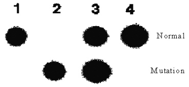 In the following dot blot, the probe used in the upper row is for the normal sequence while the probe in the second row is for the -Phe mutation of the cystic fibrosis gene.What are the genotypes of the four people investigated?   A) Normal; affected; heterozygote; normal. B) Affected; normal; heterozygote; affected. C) Normal; heterozygote; affected; normal. D) Affected; affected; heterozygote; normal. E) Heterozygote; affected; heterozygote; heterozygote.