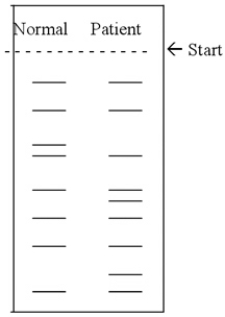 The following Southern blot was performed to examine a mutation that is linked to a genetic disease.The blot was probed with fluorescent-labeled cDNA of the gene.What is the most likely explanation for the abnormal bands in the patient in comparison with the normal control?   A) Faulty splicing of the messenger RNA (mRNA) . B) The deletion of an entire exon. C) A single-nucleotide polymorphism. D) Duplication of at least one exon. E) The expansion of a microsatellite.