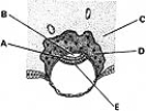   ________ Ventral layer of embryonic disc A) A B) B C) C D) D E) E