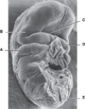   ______ Defect in its formation results in a severe type of spina bifida A) A B) B C) C D) D E) E