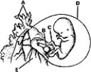   ________ Chorionic sac A) A B) B C) C D) D E) E