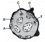   ________ Fibrinoid material A) A B) B C) C D) D E) E