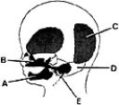   ________ Forms in the maxillary prominence of the first pharyngeal arch A) A B) B C) C D) D E) E