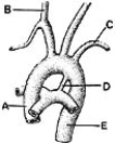   ________ Derivative of an intersegmental artery A) A B) B C) C D) D E) E