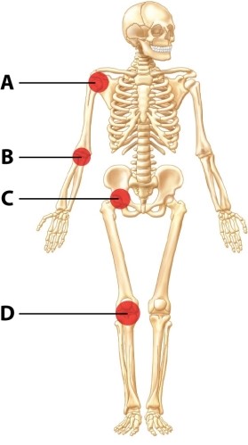 Which structure is the LEAST stable type of joint?   A) structure A B) structure B C) structure C D) structure D