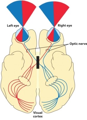 The Diagram Shows the Pathway of Axons from the Retina to the | Biology+