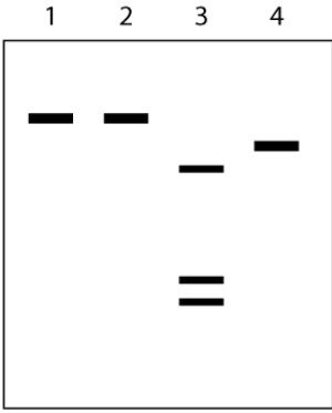 In order to test the effects of a new drug, you isolate the messenger RNA molecules from both treated and untreated eukaryotic cells and separate them according to size using gel electrophoresis. In each lane of the gel, the shorter RNA molecules migrate more quickly through the gel and end up near the bottom of the gel while the longer RNAs migrate more slowly and remain near the top.   The samples that were loaded into each of the four lanes are as follows: Lane 1: the primary RNA transcripts isolated from the nucleus of untreated cells Lane 2: the primary RNA transcripts isolated from the nucleus of cells treated with the drug being tested Lane 3: RNA isolated from the cytosol of untreated cells Lane 4: RNA isolated from the cytosol of cells treated with the drug being tested Which of the following conclusions is most likely to be CORRECT? A) These results suggest that the drug inhibits post-translational processing of this gene. B) These results suggest that the drug contains a protease that targets this gene product. C) These results suggest that the drug digests DNA. D) These results suggest that the drug affects RNA processing. E) These results suggest that the drug inhibits DNA replication.