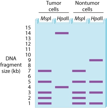 A researcher notices that women working in the petrochemical industry who are exposed to aromatic hydrocarbons may have a greater incidence of breast cancer than women without such exposure. The researcher undertakes a study of the BRCA1 promoter using the restriction enzymes MspI and HpaII. MspI cleaves double-stranded DNA at 5'-CCGG-3' regardless of whether the CG in the middle has cytosine methylation, whereas HpaII cleaves double-stranded DNA at 5'-CCGG-3' only when the CG in the middle lacks cytosine methylation. For a region of double-stranded DNA in the promoter region of BRCA1, tumor cells from the breasts of exposed women with breast cancer and nontumor cells from breasts from the same women show the illustrated patterns of bands produced by MspI and HpaII: Which of the following statements are supported by this evidence? A)More sites are methylated in tumor cells than in nontumor cells. B)Fewer sites are methylated in tumor cells than in nontumor cells. C)The same sites are methylated in tumor cells as in nontumor cells. D)No sites are methylated in nontumor cells. E)The BRCA1 gene may be epigenetically silenced in tumor cells.