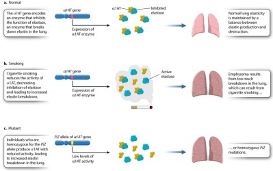 Which statement about the PiZ allele is NOT true? Consult Figure 15.2 below.   A) The PiZ allele is common in populations of European descent. B) The product of nonmutant alleles of the gene inhibits elastase in the lungs. C) Individuals homozygous for the PiZ allele have normal lung elasticity. D) Normal lung elasticity depends on elastase inhibition. E) Smokers who are homozygous for the PiZ allele have a shortened life expectancy.