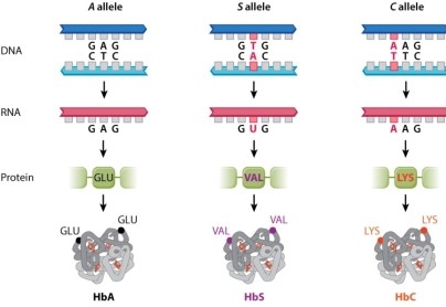 Figure 15.1 shows the three alleles for the beta-globin gene.   Which of the following statements BEST describes the effect of having the S allele, which codes for sickle-cell anemia? A) Having the allele is always harmful. B) Having the allele is always beneficial. C) The effect depends on whether the allele occurs in its homozygous or heterozygous form. D) The effect depends on the environment (i.e., whether malaria is present) . E) The effect depends on whether the allele occurs in its homozygous or heterozygous form, and the environment (i.e., whether malaria is present) .