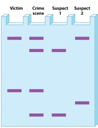 <strong>The figure below represents analysis of blood from a victim of a crime and two suspects. Criminologists created this Southern blot with restriction fragments from a variable number tandem repeat (VNTR) site. Which suspect could be convicted based on these data alone?</strong> A)suspect 1 B)suspect 2 C)both D)neither