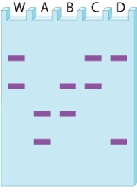 The gel diagram below shows the bands obtained for a single variable number tandem repeat (VNTR)  in evidence obtained at a crime scene (W)  and genomic DNA from four suspects (A-D) .     Which suspect CANNOT be ruled out as the source of the DNA in the sample? A) suspect A B) suspect B C) suspect C D) suspect D E) All four suspects can be ruled out.