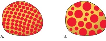 Two independent mutants are discovered in a strain of fruit flies. Both are due to the insertion of a transposable element into a gene that is required to produce red pigment in the eyes, but the eyes are yellow instead of red. When the transposon undergoes transposition to another location, the copy present in the original location is sometimes deleted. When the copy in the gene required for red pigment is deleted, the gene regains its ability to function, and the cell with the deletion and all its descendants can produce the red pigment. In one mutant, A shown below, the eyes have tiny red sectors scattered throughout, whereas in the other mutant, B, the eyes have larger blotches of color. What do these patterns tell you about the transposition of the transposons in the mutants A and B?   A) The transposons in A and B transpose at about the same time in development. B) The transposon in A tends to transpose at an earlier time in development than that in B. C) The transposon in A tends to transpose at a later time in development than that in B. D) The transposon in A is likely a retrotransposon, which in B is a DNA transposon. E) The transposon in A is likely a DNA transposon, which in B is a retrotransposon.