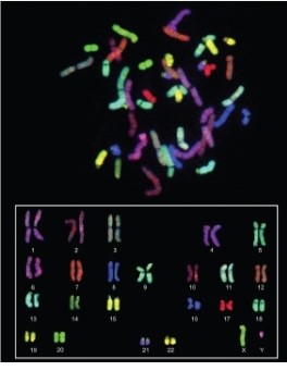 Chromosome painting (see Figure 13.14)  is achieved by labeling various DNA fragments with different fluorescent molecules and hybridizing those to human chromosomes spread on a microscope slide. The result, if done properly, is that each chromosome can be visualized as having a different color.     Photo credit: NHGRI, www.genome.gov. Given the ability to paint each chromosome differently, what else must be TRUE? A) No similar gene sequences are found on more than one chromosome. B) Each chromosome must have at least some sequences not found on other chromosomes. C) Transposable element sequences must cluster together on single chromosomes. D) Each chromosome condenses around histones in its own way. E) None of the other answer choices is correct.