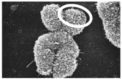 Which of the following is circled in this electron micrograph?   Photo credit: Biophoto Associates/Science Source A) one double-stranded DNA molecule B) one single strand of a DNA molecule C) two double-stranded DNA molecules