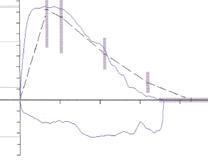 Which interpretation is consistent with the following flow-volume curve?   A)  Normal flow-volume loop B)  Variable intrathoracic obstruction C)  Variable extrathoracic obstruction D)  Fixed large airway obstruction