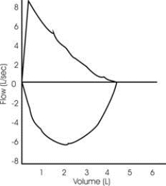 Which of the following diagnoses is consistent with the following flow-volume curve?   A)  Variable intrathoracic obstruction B)  Fixed extrathoracic obstruction C)  Small airway obstruction D)  Normal expiratory and inspiratory flows