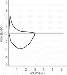 Which answer is consistent with the flow-volume curve shown?   A)  Normal forced expiratory flow pattern B)  Variable intrathoracic obstruction C)  Airway obstruction D)  Fixed extrathoracic obstruction