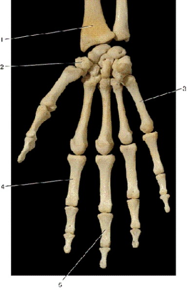   -In the above anterior view of the right hand,number 3 indicates what bone? A) proximal phalanx B) metatarsal C) distal phalanx D) metacarpal