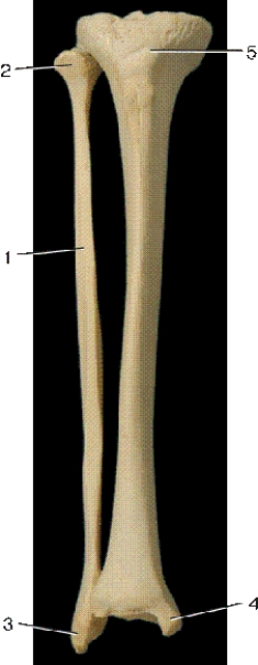   -In the above anterior view of the right leg bones,number 3 indicates what bony landmark? A) medial malleolus B) lateral malleolus C) head of the fibula D) tibial condyle