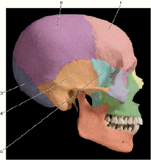   -In the above right lateral view of the skull,number 2 indicates what bone? A) sphenoid B) temporal C) parietal D) occipital