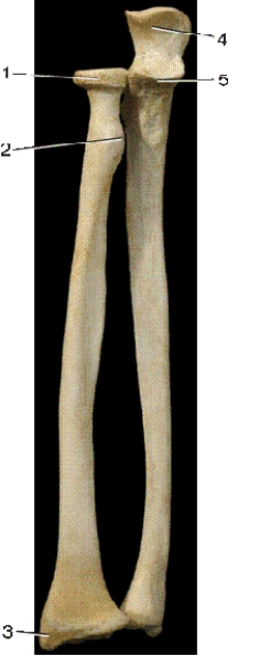   -In the above anterior view of the right forearm bones,number 2 indicates what bony landmark? A) tuberosity B) olecranon C) styloid process D) coracoid process