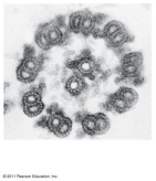   -The above image is a cross section of a A) centriole. B) basal body. C) microfilament. D) actin. E) flagella.