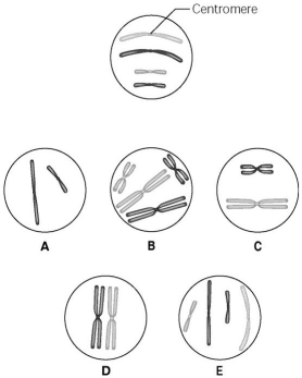 <strong>Use the following information to answer the questions below. The lettered circle in the figure below shows a diploid nucleus with four chromosomes. There are two pairs of homologous chromosomes, one long and the other short. One haploid set is symbolized as black and the other haploid set is grey. The chromosomes in the unlettered circle have not yet replicated. Choose the correct chromosomal conditions for the following stages. What is the correct chromosomal condition for one daughter nucleus at telophase of mitosis?</strong> A)A B)B C)C D)D E)E