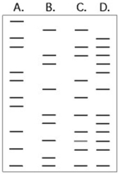 Use the following figure to answer the questions below. The DNA profiles that follow represent four different individuals.    -Which of the following statements is most likely true? A) D is the child of A and C. B) D is the child of A and B. C) D is the child of B and C. D) A is the child of C and D. E) B is the child of A and C.