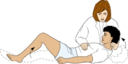 Which neurologic assessment is being performed in the exhibit?   A)  Kernig's sign B)  Babinski reflex C)  Brudzinski sign D)  Decorticate posturing 
