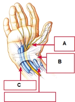   -Carpal tunnel syndrome is a condition whose effects are made worse by keyboard use.The accompanying figure represents a hand.Box B indicates the ____. A)  median nerve B)  transverse carpal ligament C)  carpal bones D)  tendons and sheaths