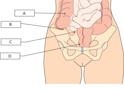   A nurse checking for tenderness at McBurney's point for a client with suspected appendicitis will palpate which area? A)  A B)  B C)  C D)  D