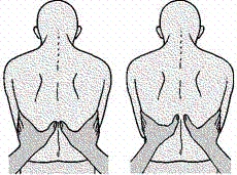 Using the illustrated technique,the nurse is assessing for which finding in a patient with chronic obstructive pulmonary disease (COPD) ?   A)  Hyperresonance B)  Tripod positioning C)  Accessory muscle use D)  Reduced chest expansion
