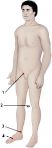 When the nurse is screening patients for possible peripheral arterial disease,indicate where the posterior tibial artery will be palpated.   A)  1 B)  2 C)  3 D)  4