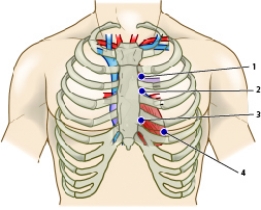 <strong>The nurse is caring for a patient with mitral regurgitation.Referring to the figure below,where should the nurse listen to best hear any murmur that the patient has?  </strong> A) 1 B) 2 C) 3 D) 4 <div style=padding-top: 35px> 