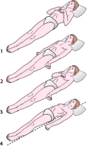 During change-of-shift report,the nurse learns that a patient with a head injury has decorticate posturing to noxious stimulation.Which positioning shown in the accompanying figure will the nurse expect to observe?   A)  1 B)  2 C)  3 D)  4