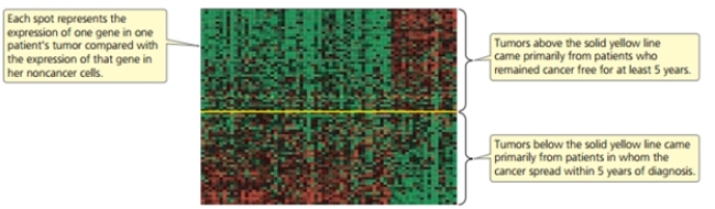 The following is a microarray that includes genes identified in breast cancer tumors.Why is this gene expression pattern important?   [Reprinted by permission from Macmillan Publishers Ltd.L.J.van'T Veer et al.,  Gene expression profiling predicts clinical outcome of breast cancer,   Nature 405:532.© 2002.] A) It can tell us something about which genes are involved in more invasive or aggressive breast cancer. B) It can tell us the prognosis of new patients. C) It can tell us which mutations caused the cancer. D) It can show us which cDNA is better for diagnosing cancer. E) It can both tell us something about which genes are involved in more invasive or aggressive breast cancer and tell us the prognosis of new patients.