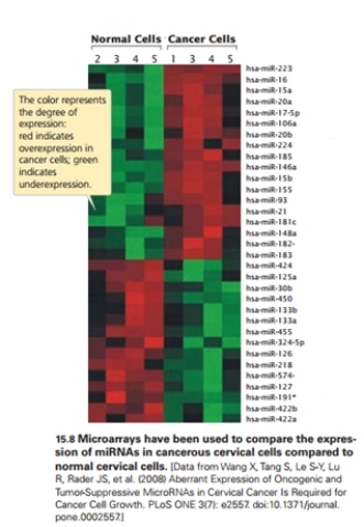 This following microarray, comparing normal and cancer cells shows that the:   A) top part of the panel are miRs overexpressed in cancer. B) top part of the panel are miRs under-expressed in normal cells. C) bottom part of the panel are miRs overexpressed in cancer. D) bottom part of the panel are miRs under expressed in normal cells. E) top part of the panel are miRs that are both overexpressed in cancer and under-expressed in normal cells.