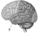  -The line points to the A)  central fissure. B)  superior temporal gyrus. C)  postcentral fissure. D)  longitudinal fissure. E)  parietal lobe.